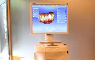 CEREC4.5　オムニカム